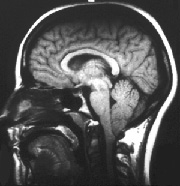 Chiari_Overview_Fig1.jpg