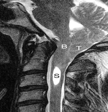 MRI.bmp